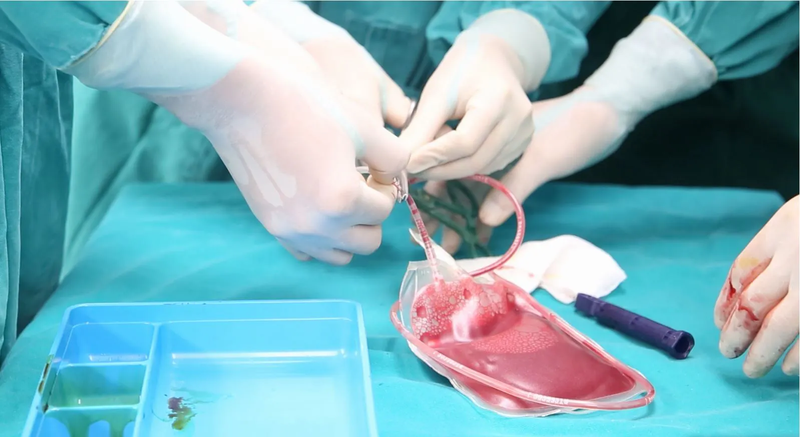 Cách điều trị ung thư máu bằng tế bào gốc 2