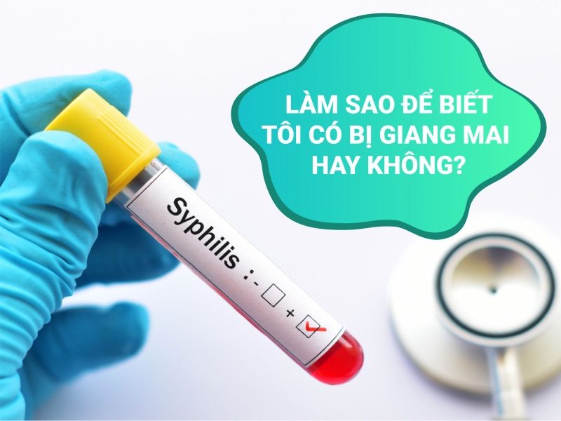 CCách điều trị và phòng ngừa giang mai ở lưỡi 1
