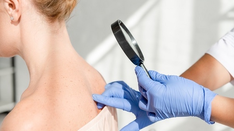 Cách điều trị và phòng ngừa khi bị viêm da tiếp xúc do côn trùng 5