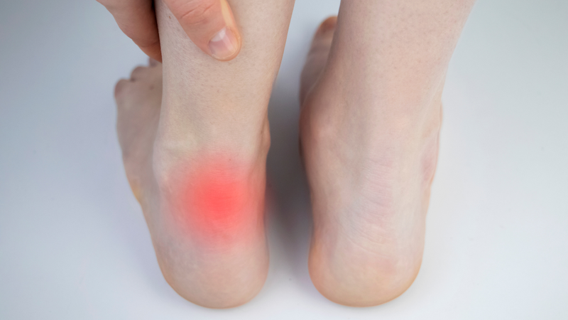 Cách điều trị viêm gân gót chân tại nhà 3