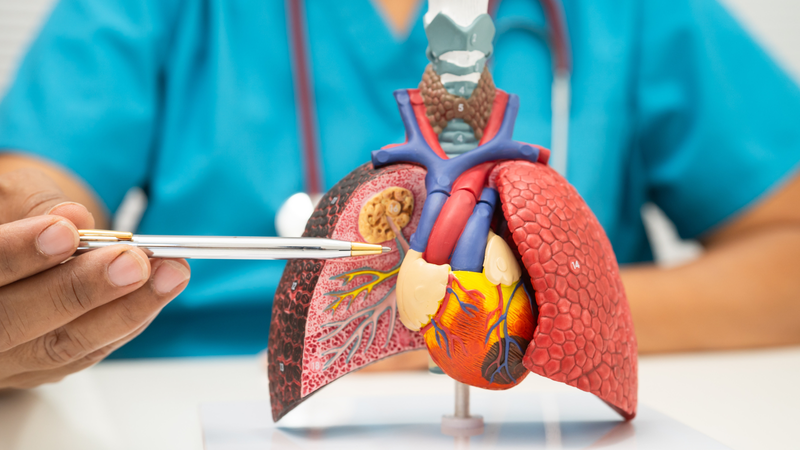 Có những cách điều trị xơ phổi nào?