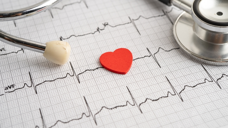 Điện tâm đồ là một biểu đồ ghi lại các biến đổi của dòng điện trong tim người theo thời gian