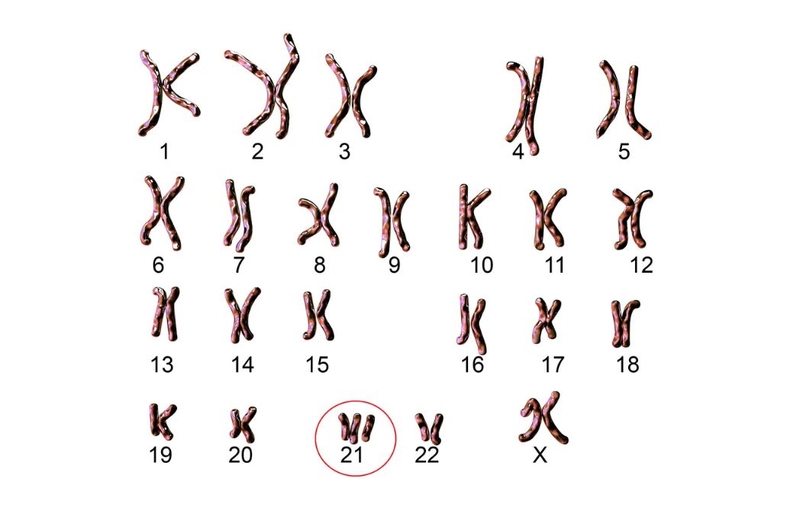 Karyotype là gì? Hướng dẫn chi tiết cách đọc Karyotype 1