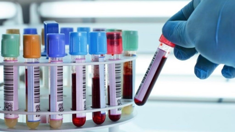 cach-doc-ket-qua-chup-tu-cung-voi-trung-nhung-luu-y-can-biet 4