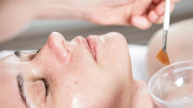 Cách đơn giản nhất để giảm thâm nám và tàn nhang là gì? 3