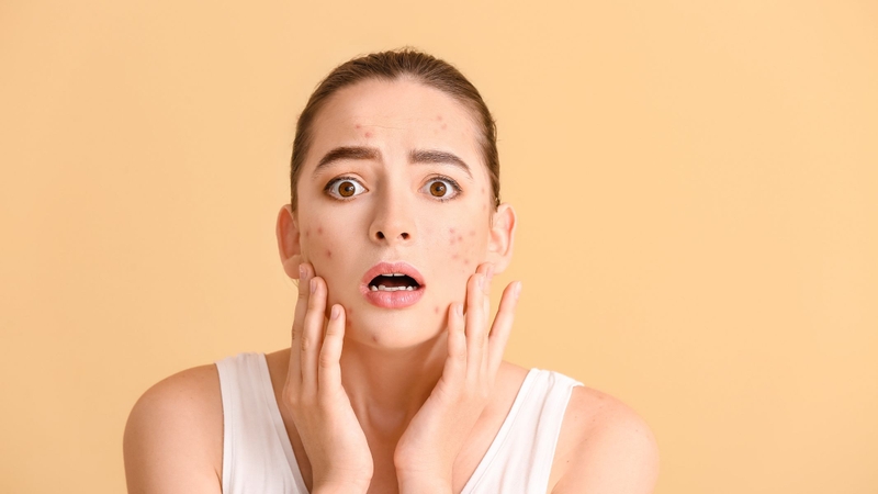 Dùng BHA có bị đẩy mụn không?