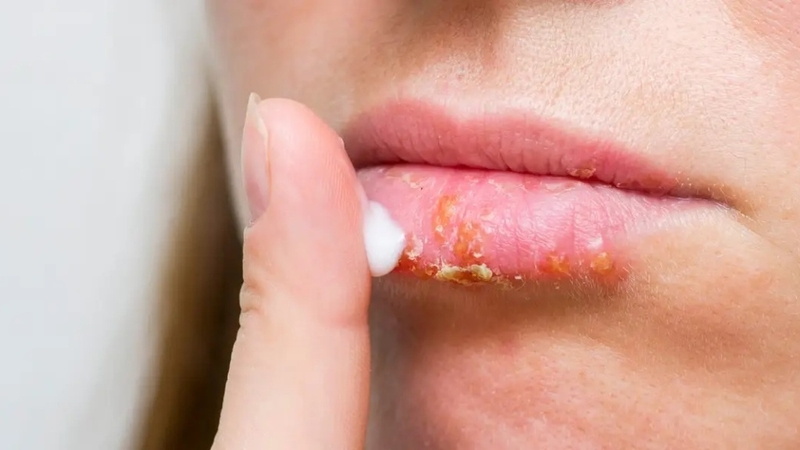 Cách dưỡng môi ban đêm cho đôi môi căng mọng, hồng hào 2