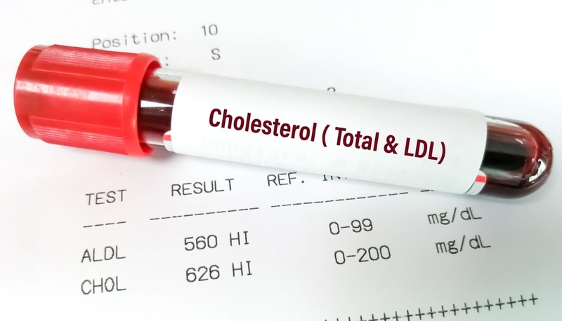 Cách giảm cholesterol mà người có cholesterol cao nhất định phải biết 1