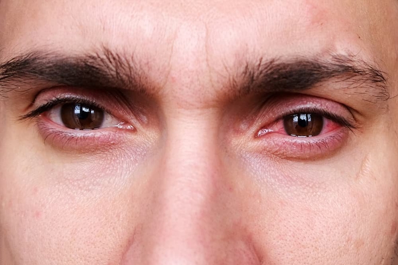 Việc bị đau mắt có thể do nhiều nguyên nhân khác nhau