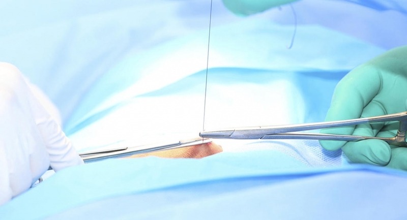 Rạch tầng sinh môn là một phương pháp thông thường được sử dụng trong quá trình sinh nở