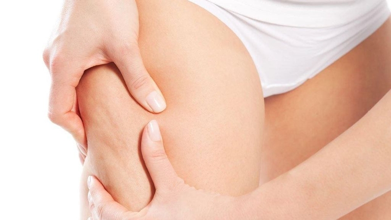 Cách giảm mỡ đùi sao cho an toàn và hiệu quả? 2