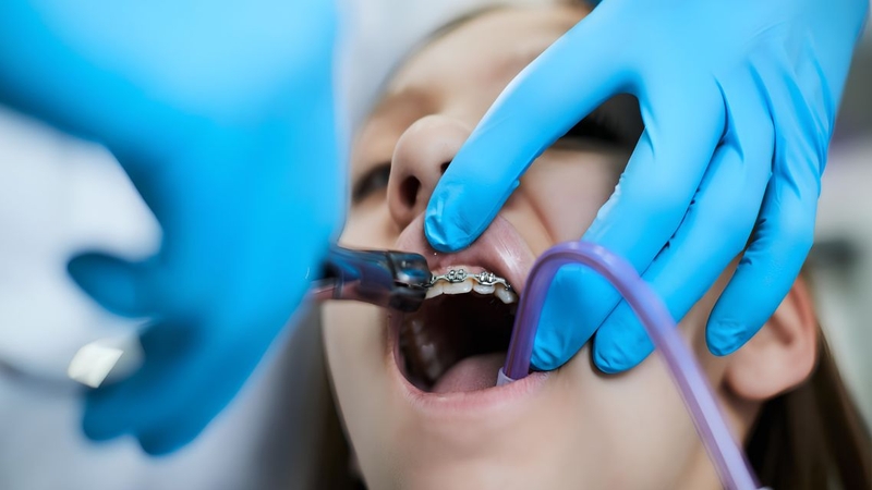 Nên đi khám nha sĩ khi màu sắc men răng có dấu hiệu bất thường