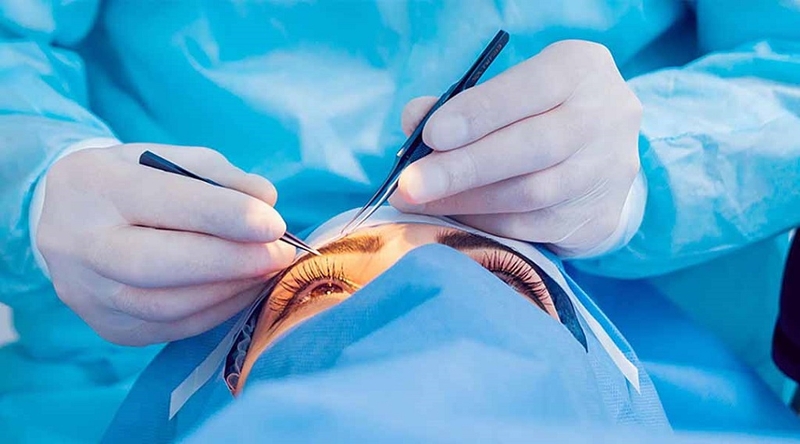 Giới thiệu về những cách hạ nhãn áp 1