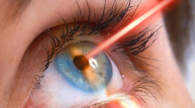 Giới thiệu về những cách hạ nhãn áp 2