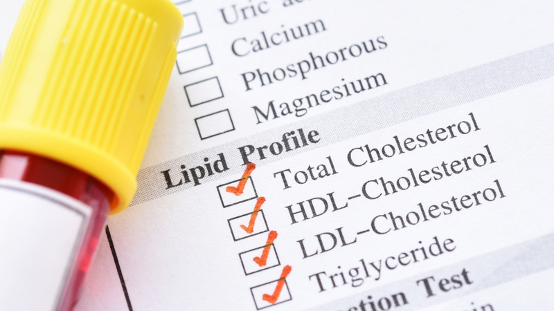 Cách kiểm tra mỡ máu tại nhà giúp bạn chủ động theo dõi các chỉ số lipid trong máu