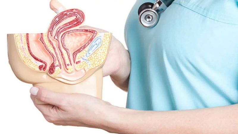 Cách kiểm tra sa tử cung, hướng xử trí và các biện pháp phòng ngừa sa tử cung 2