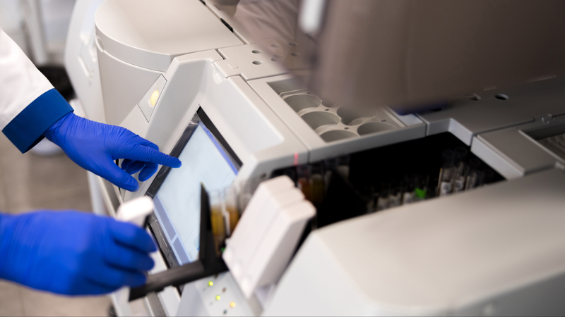 Xét nghiệm miễn dịch nhằm loại trừ các bệnh lây qua đường tình dục