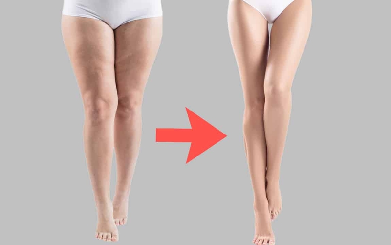 Cách làm bắp chân nhỏ lại trong 1 tuần nhanh nhất 3