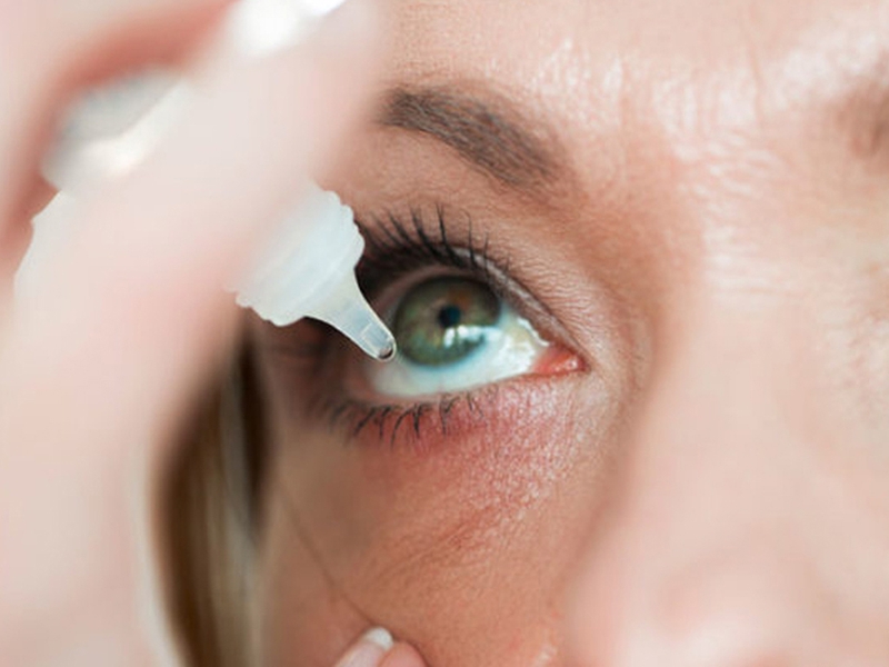 Cách làm xẹp mụt lẹo tại nhà đơn giản mà hiệu quả