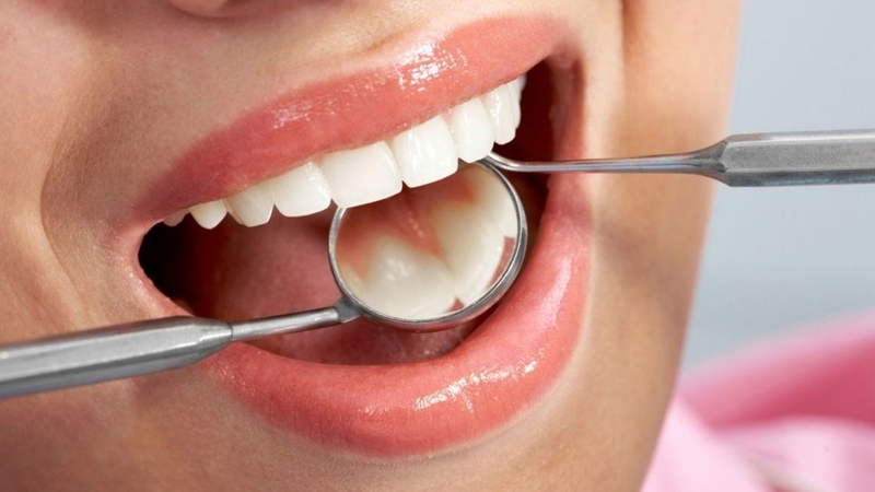 cach-lay-soi-amidan-nhung-luu-y-can-biet 4