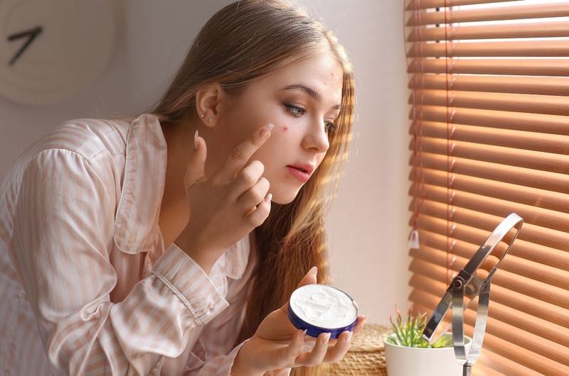 Loại mụn nào có thể nặn? Thế nào là cách nặn mụn đúng cách 3