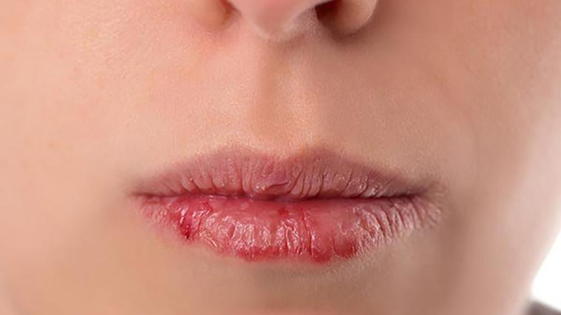 Cách nhận biết sớm hội chứng tăng glucose máu và xử lý kịp thời 1