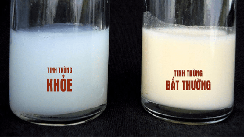 Cách nhận biết tinh trùng loãng hay đặc