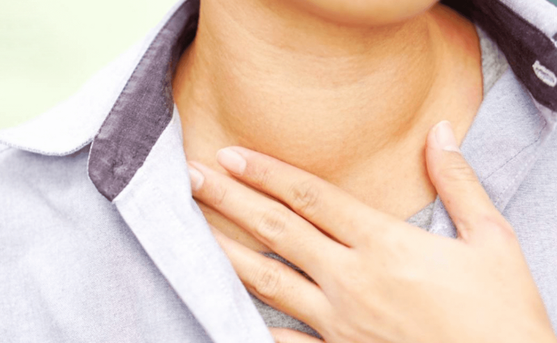 Cách phân biệt bệnh bướu cổ và bệnh bazơđô 2