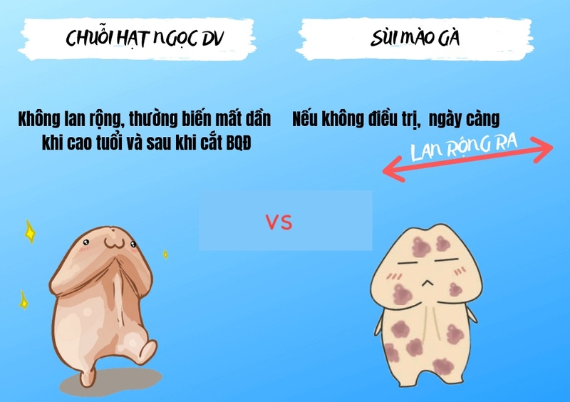 Cách phân biệt chuỗi hạt ngọc và sùi mào gà 2