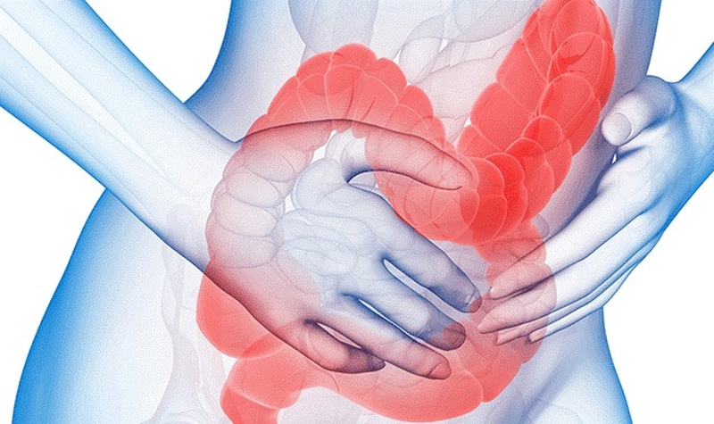 Cách phân biệt dấu hiệu bệnh viêm dạ dày và hội chứng ruột kích thích 1