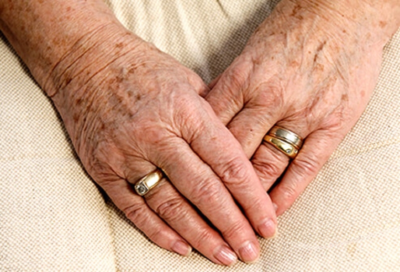 Cách phân biệt đồi mồi và tàn nhang chính xác nhất 3