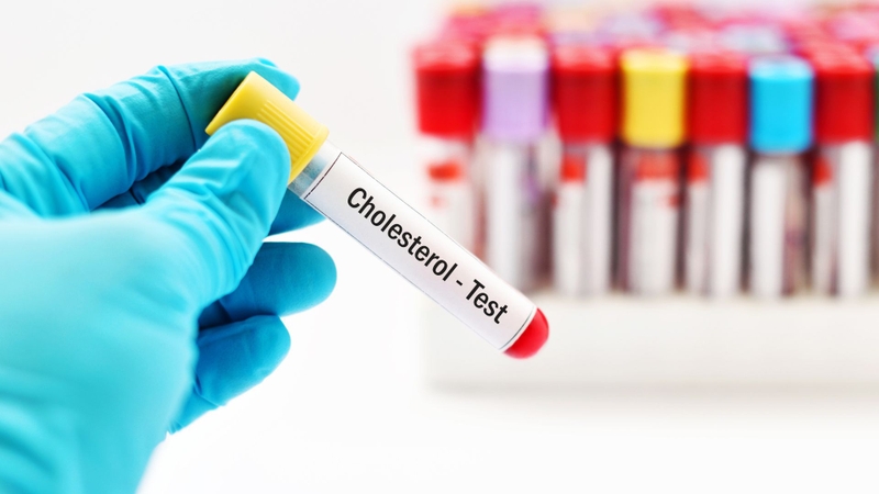 Cách phòng bệnh xơ vữa động mạch hiệu quả cần được thực hiện sớm 3