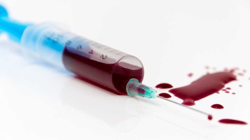 Cách phòng chống HIV giúp bạn kiểm soát tốt nguy cơ mắc bệnh 3