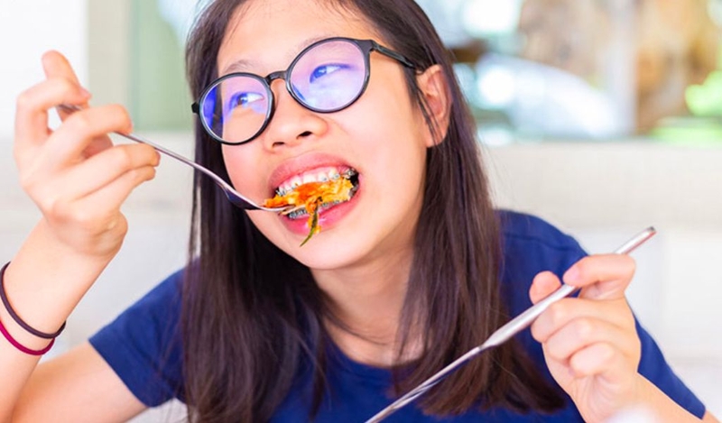 Cách phòng ngừa và xử lý tuột dây cung khi niềng răng như thế nào? 1