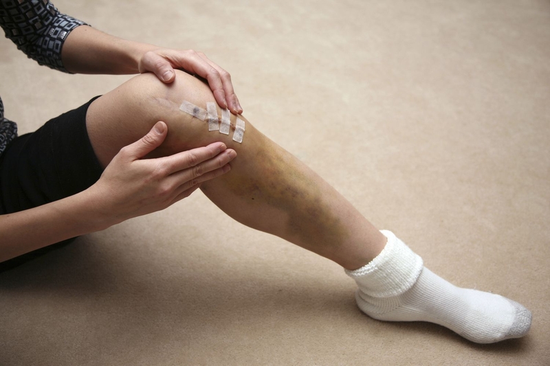 Cách phục hồi cứng khớp gối sau phẫu thuật tái tạo dây chằng 1