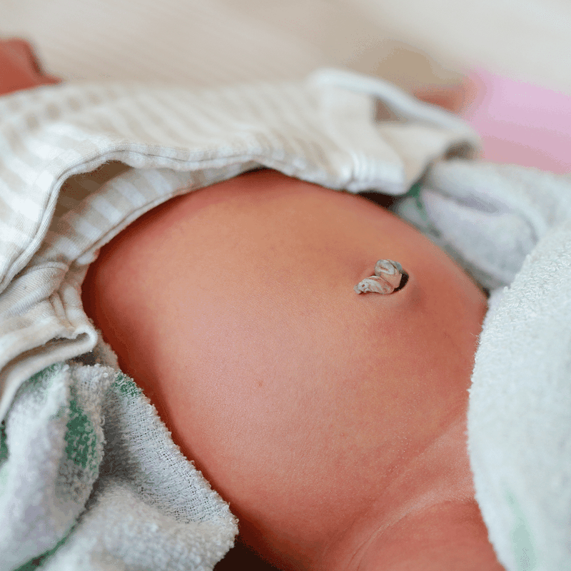 Cha mẹ cần thường xuyên kiểm tra cuống rốn của trẻ để kịp thời điều trị