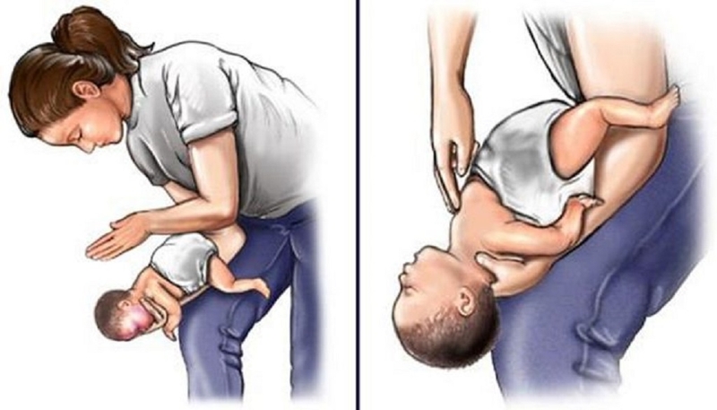 Cách sơ cứu hóc dị vật đường thở ở trẻ em 3