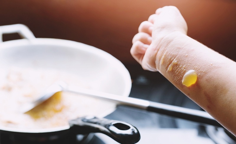 Nấu nướng hàng ngày có thể khiến bạn dễ bị bỏng tay do dầu bắn ra trong khi chiên rán