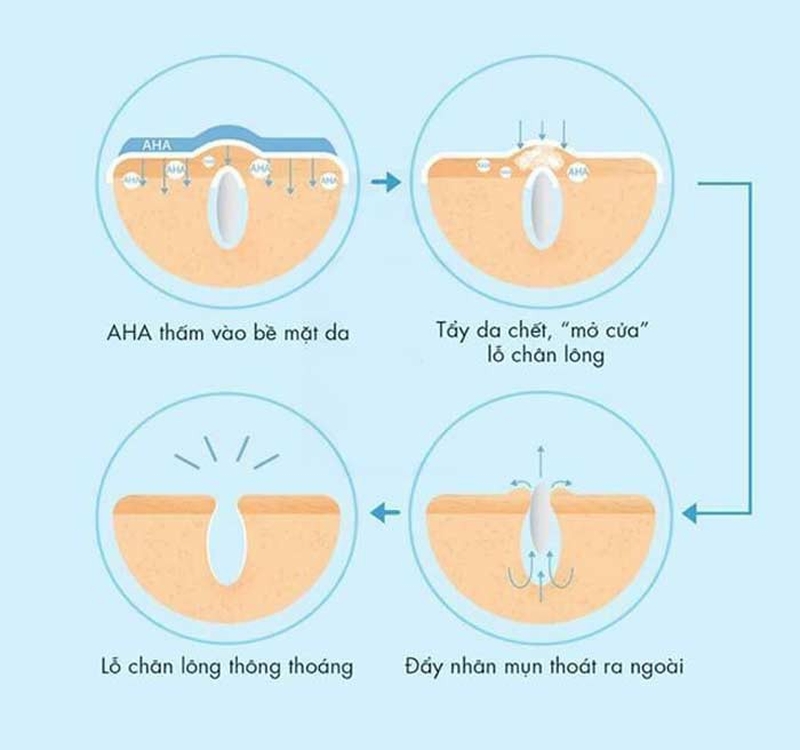 AHA là gì? Hướng dẫn cách sử dụng AHA đúng cách và an toàn