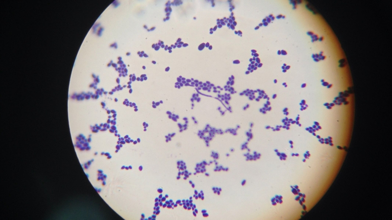 Xịt sản phẩm lên quần lót còn ẩm làm cho vi khuẩn và nấm phát triển