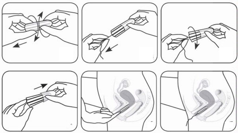 Cách sử dụng Tampon hiệu quả và an toàn mà bạn nên biết 3