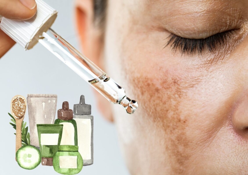 Cách sử dụng và những lưu ý khi sử dụng hydroquinone trị nám 3