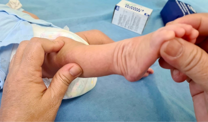 Cách sửa dáng đi 2 hàng, chân cong từ trẻ nhỏ đến người lớn 1