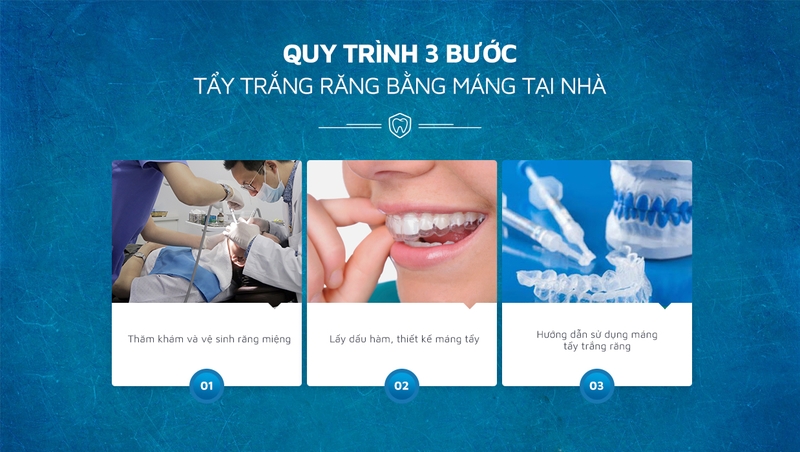 Cách tẩy trắng răng tại nhà, lưu ý khi tẩy trắng răng tại nhà 2