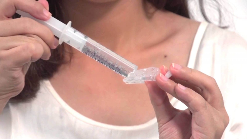 Cách tẩy trắng răng tại nhà, lưu ý khi tẩy trắng răng tại nhà 3