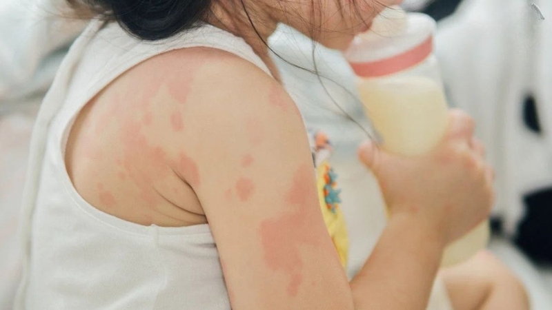 Cha mẹ cần tham khảo ý kiến bác sĩ trước khi cho trẻ thử lại sữa