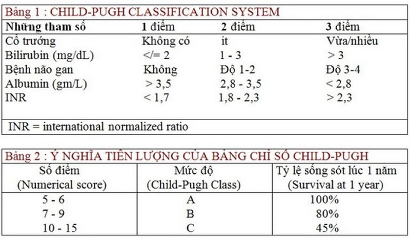Cách tính phân độ child trong xơ gan 2