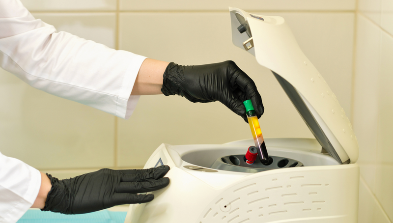 Cách tính thể tích huyết tương: Nguyên tắc, công thức và ứng dụng trong lâm sàng 3