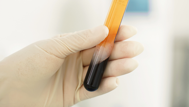 Cách tính thể tích huyết tương: Nguyên tắc, công thức và ứng dụng trong lâm sàng 1