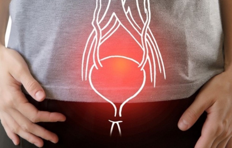 Bàng quang tăng hoạt là nguyên nhân gây bệnh đái dầm ở người lớn